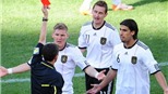 Nỗi đau của Klose: Khi sự nông nổi chẳng chừa một ai
