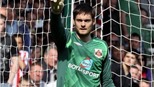 Craig Gordon gãy tay
