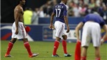 Pháp thua đau trước Belarus ngay trên sân nhà