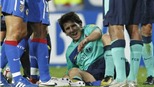 Messi dính chấn thương mắt cá