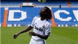 "Đối thủ" của Benzema:  "Adebayor khỏe như trâu"