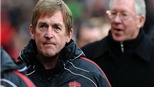  Bí quyết của Dalglish
