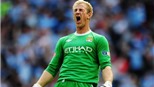 Man City trói chân Joe Hart