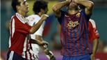 Barca thua hai trận liên tiếp, Guardiola vẫn bình thản