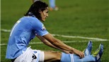 Napoli trả giá đắt cho chiến thắng ở Champions League