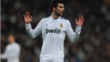 Real Madrid thiệt hại nặng nề vì "virus FIFA"