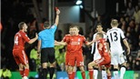Mất người, Liverpool bại trận trước Fulham