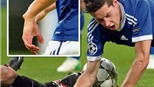 Sau Puyol, một cầu thủ của Schalke cũng gãy tay ở Champions League
