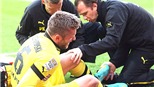 Dortmund kiệt sức vì chạy nhiều?