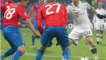 Bayern Munich giành vé sớm: Chiến thắng nhỏ, nỗi lo lớn