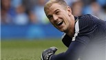 Man City có tiếc khi để Joe Hart ra đi?