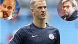 Klopp, Guardiola, và gạch nối Joe Hart