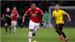 Guardiola cực thích Anthony Martial vì 'tài năng chẳng kém Mbappe'