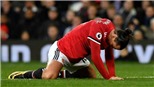 ĐIỂM NHẤN M.U 2-2 Burnley: Mourinho có tội. Cả tập thể M.U xuống dốc