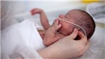 Đồ họa: Vì sao Việt Nam có tỷ lệ tử vong ở trẻ sinh non cao?