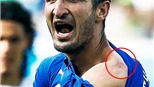 Cần có công nghệ &#39;Bite - line&#39; để xác định Suarez cắn đối thủ
