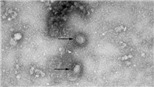 Trung Quốc thông báo trường hợp thứ 2 tử vong vì virus corona mới