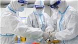Virus SARS-CoV-2 có thể lây nhiễm qua nói chuyện hoặc hơi thở