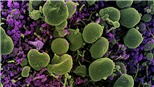Các nhà khoa học ​Pháp phát hiện biến thể mới của virus SARS-CoV-2 chứa 46 đột biến