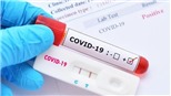 Test nhanh Covid-19: Không nên lạm dụng