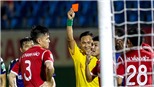 V-League tranh tối, tranh sáng