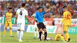 Vòng 18 V-League 2018: Thiếu chuyên môn, thừa bạo lực