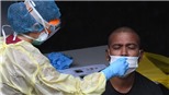 Singapore phát hiện biến thể của virus SARS-CoV-2 gây triệu chứng nhẹ hơn