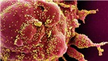 Phát hiện con đường xâm nhập khác của virus SARS-CoV-2 vào cơ thể người