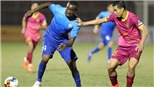 Trung vệ Sài Gòn FC đổ máu và gãy xương, phải nghỉ dài hạn
