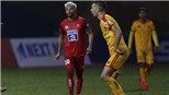 Ngoại binh chê mặt sân V-League như giải nghiệp dư