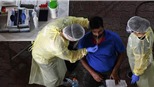 Các nhà nghiên cứu Singapore tìm ra phương pháp xét nghiệm nhanh virus SARS-CoV-2 