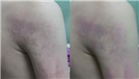 Vụ học sinh lớp 1 bị giáo viên đánh ở Hà Nội: Gia đình yêu cầu giáo viên viết cam kết