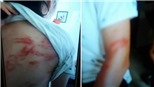 Bố đẻ bạo hành hai con dã man ngay giữa Thủ đô