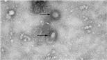 Dịch bệnh viêm phổi do virus corona: Mỹ xác nhận trường hợp thứ 5 nhiễm virus corona