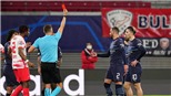 Sao Man City bị mắng thậm tệ vì dính thẻ đỏ