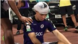 Duy Mạnh không bị chấn thương nặng vùng đầu