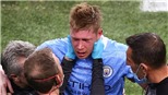 De Bruyne có thể lỡ EURO 2020 vì chấn thương nặng ở Chung kết C1